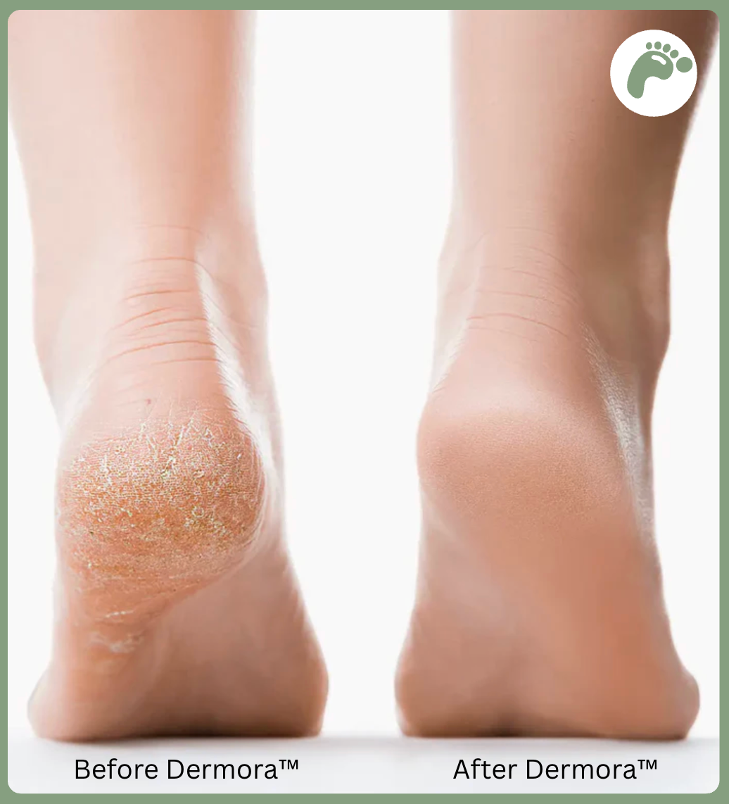 Dermora™ PediSmooth Pro